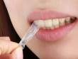 Lợi và hại khi dùng miếng dán trắng răng cấp tốc sau 1 tuần