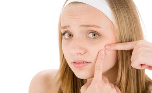 6 mẹo đối phó với những vấn đề về da từ dâu tây 5