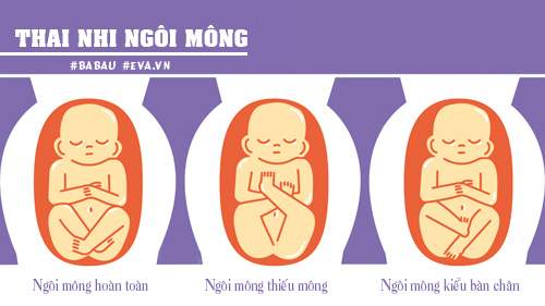 Những vị trí nằm “oái oăm” của thai nhi trong bụng mẹ 9
