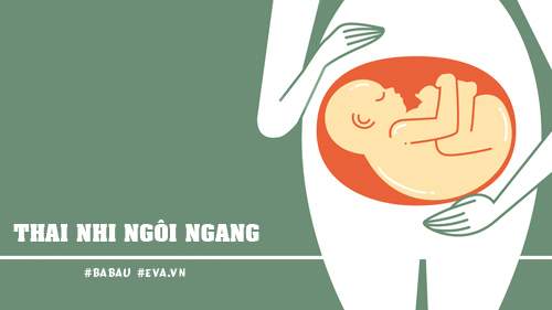 Những vị trí nằm “oái oăm” của thai nhi trong bụng mẹ 12