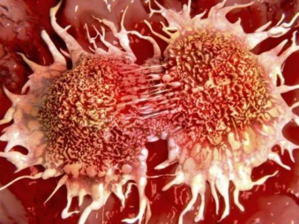 Tế bào ung thư “thích vàng”, chuyên gia nói gì? 2