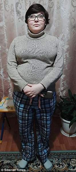 Cô gái Nga xinh đẹp bị bạn trai trả thù tàn độc vì về trễ 2
