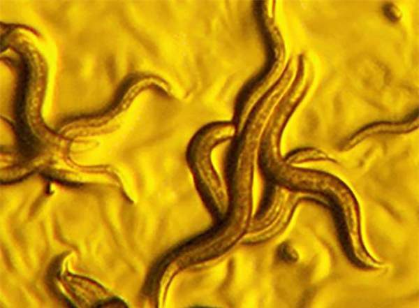 Phát hiện ra loại vi khuẩn “vàng” có khả năng “tiêu diệt” giun ký sinh