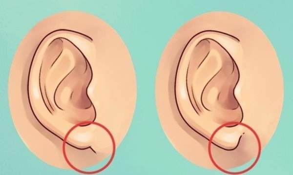 Sự thật thú vị về đôi tai hầu hết mọi người không biết 2