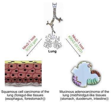 Sự kì dị của ung thư: Khi lá phổi bị biến thành dạ dày và ruột 3