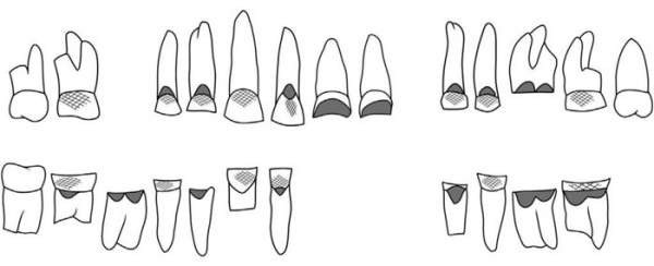 Chiếc răng 4000 năm tuổi trả lời cho câu hỏi: Người cổ đại từng làm nghề gì?