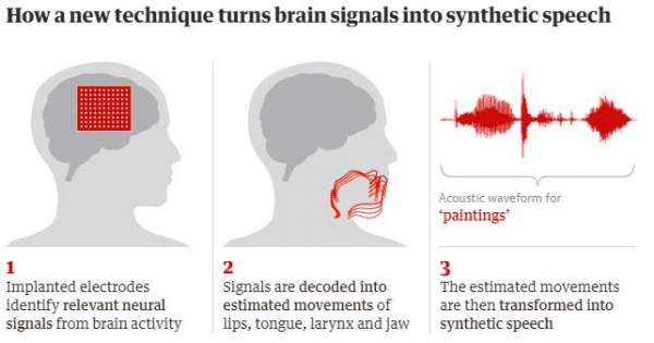 Công nghệ biến tín hiệu não thành lời nói, giúp bệnh nhân bại liệt giao tiếp 2