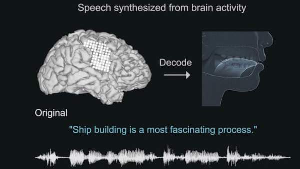 Công nghệ biến tín hiệu não thành lời nói, giúp bệnh nhân bại liệt giao tiếp