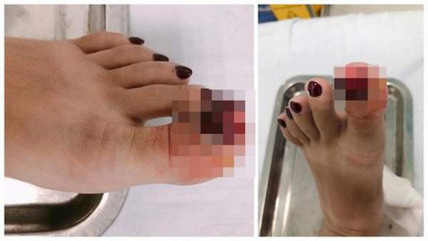 MC Hoàng Linh bị tai nạn lật ngón chân, phải nhập viện 2