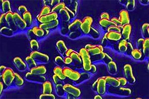 Tại sao vi khuẩn dịch hạch không thể bị diệt trừ hoàn toàn trên hành tinh?