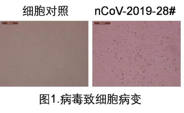 Trung Quốc phân lập được Covid-19 trong nước tiểu người bệnh
