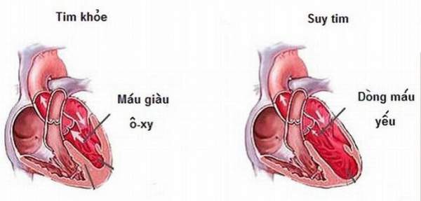 Nước tăng lực có thể gây ra suy tim ở nam giới 2