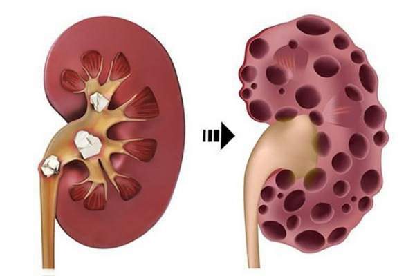 Nước tăng lực có thể gây ra suy tim ở nam giới 3